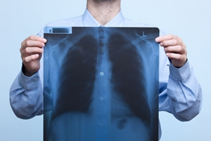 mesothelioma research